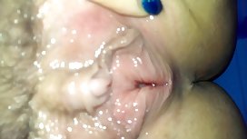 外科醫生強迫患者麻醉，這是真的！